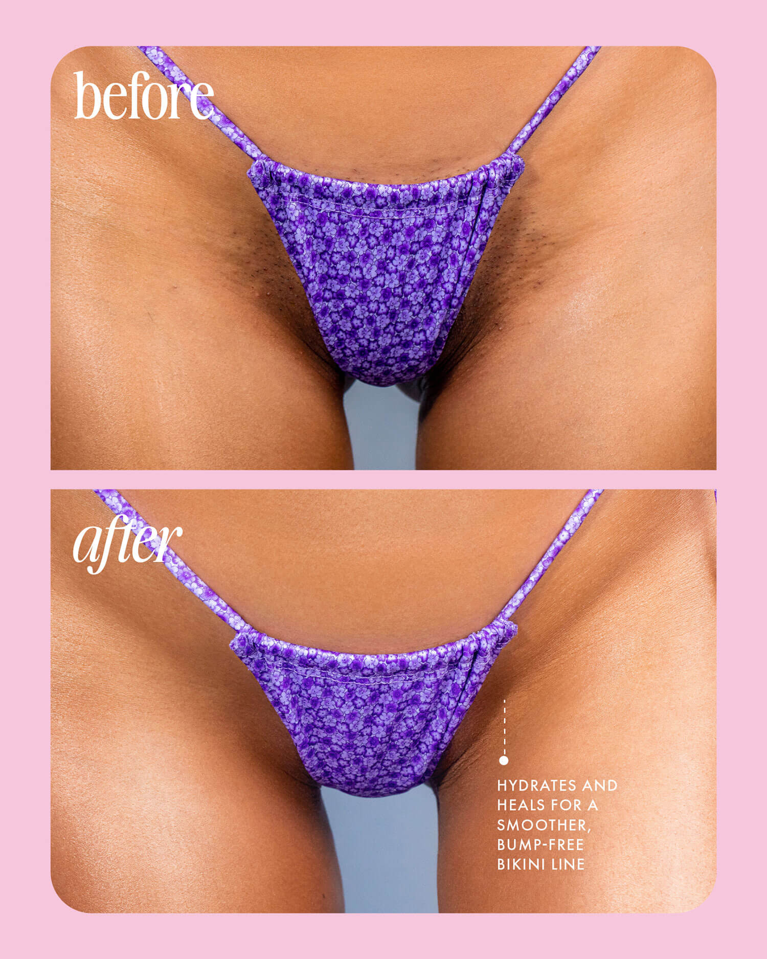 Cooka Ingrown Concentrate - Image 3