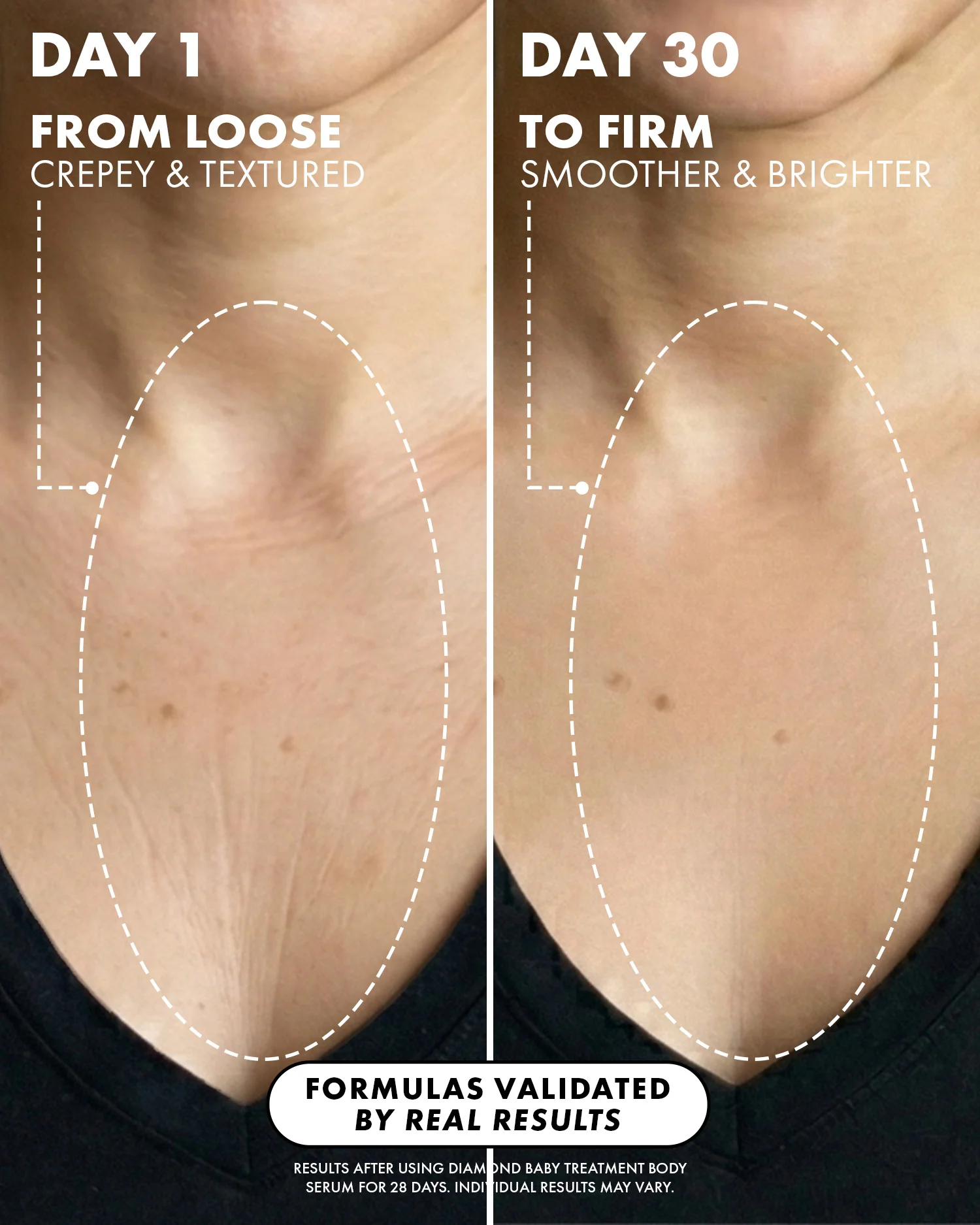 Diamond Baby Treatment Body Serum - Image 7